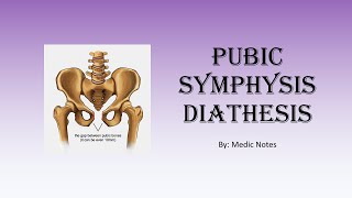 Pubic symphysis diathesis causes imaging findings treatment