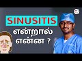 Sinusitis     sinusitis in tamil  dr manoj ent speciality centre  trichy