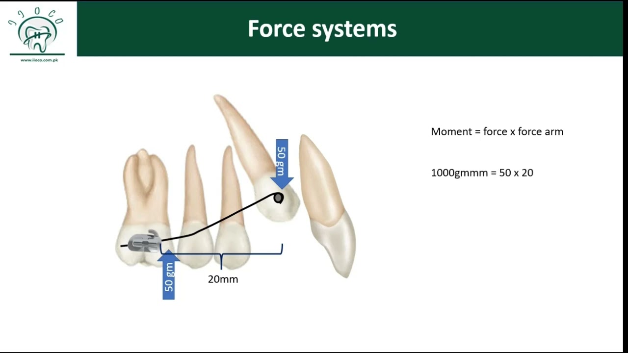 Система одной пары (часть 2)