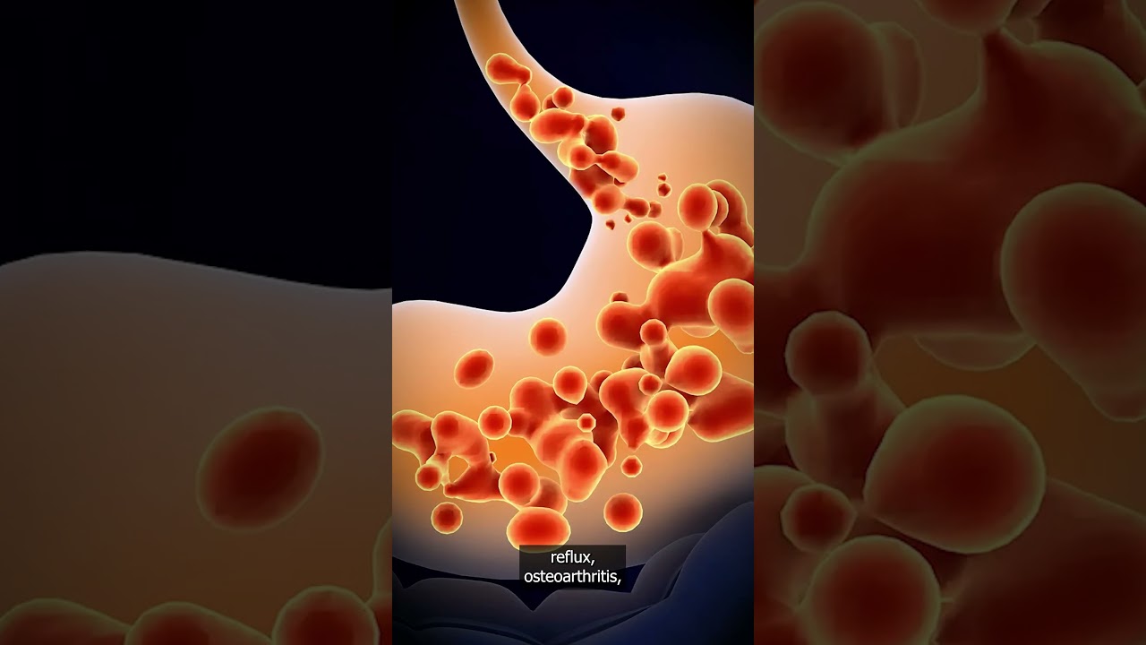 Bariatric Surgery Eligibility? | BMI Criteria, Diabetes & Weight Loss Surgery 