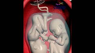 Twins fertilization- Shared beginning (3D Animated video)
