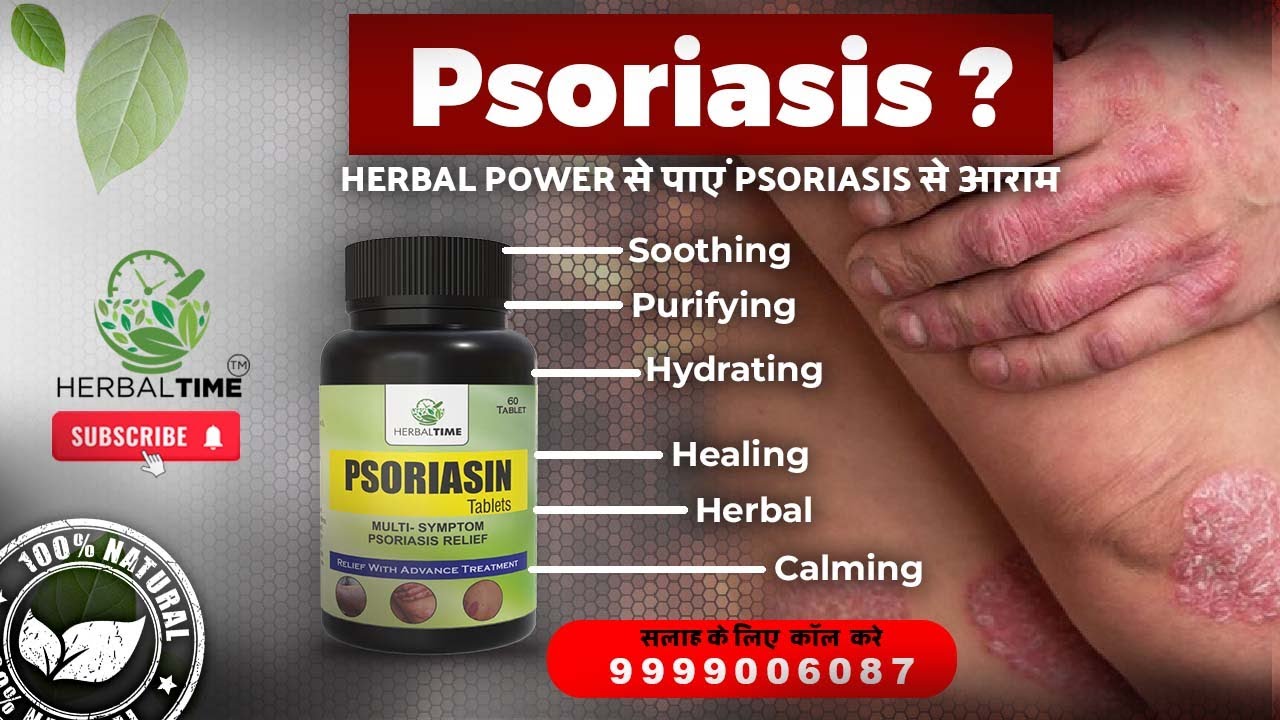 How to Cure Psoriasis? How to Cure Psoriasis Permanently? The Best