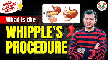 What is Whipple