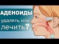 АДЕНОИДЫ у детей. Степени, осложнения и лечение