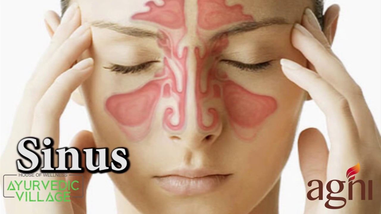 Ayurvedic Treatment for Nasal Congestion foto images Ayurvedic Treatment for Nasal Congestion