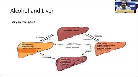 Physical consequences of substance use & dependenc...