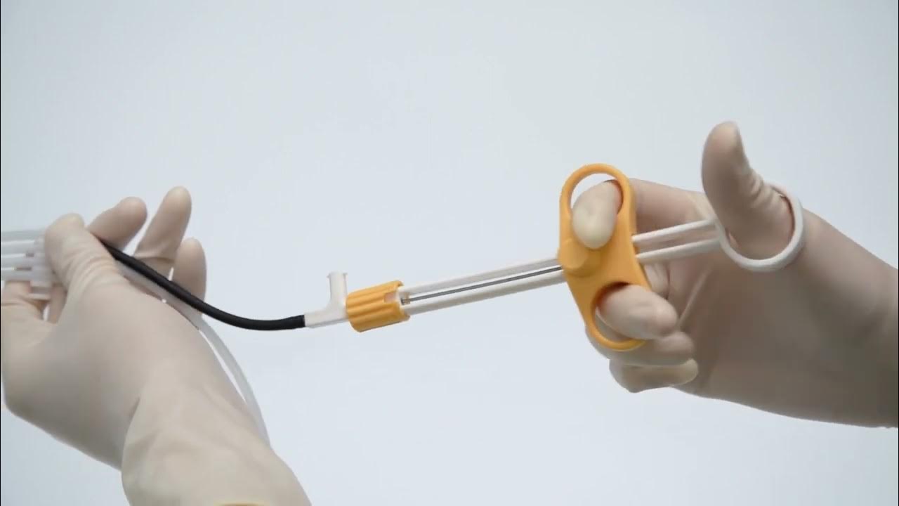 Gastroscope Diamond Shaped Stone Extraction Basket For ERCP YouTube