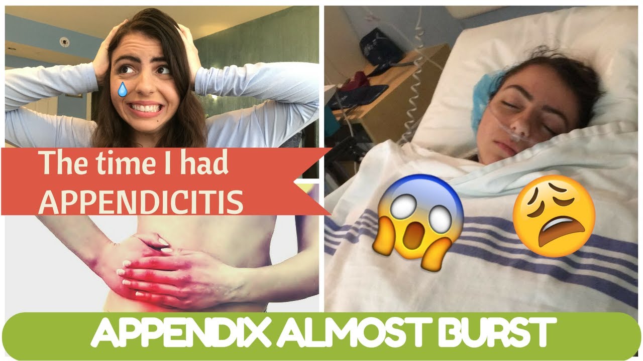 FUNNY THE TIME I FOUND OUT I HAD APPENDICITIS STORY TIME