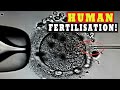 Human Sperm and Egg Fertilization Microscope - IVF ICSI Procedure