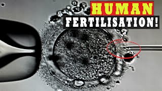 Human Sperm and Egg Fertilization Microscope - IVF ICSI Procedure