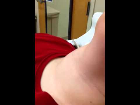 Visible pulse in neck pregnant