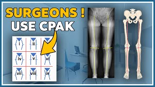 Alignment of the knee with the CPAK classification screenshot 5