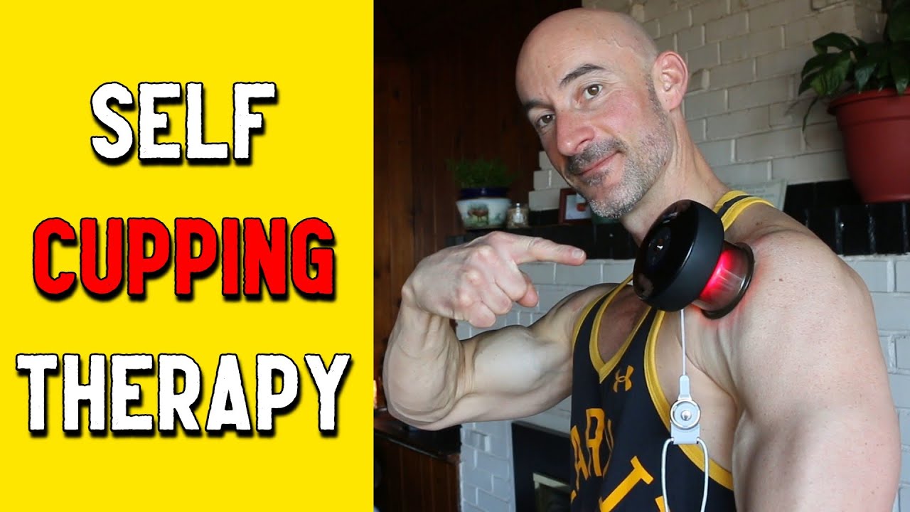 Self Cupping Therapy Game Changer - AchedAway Cupper Review