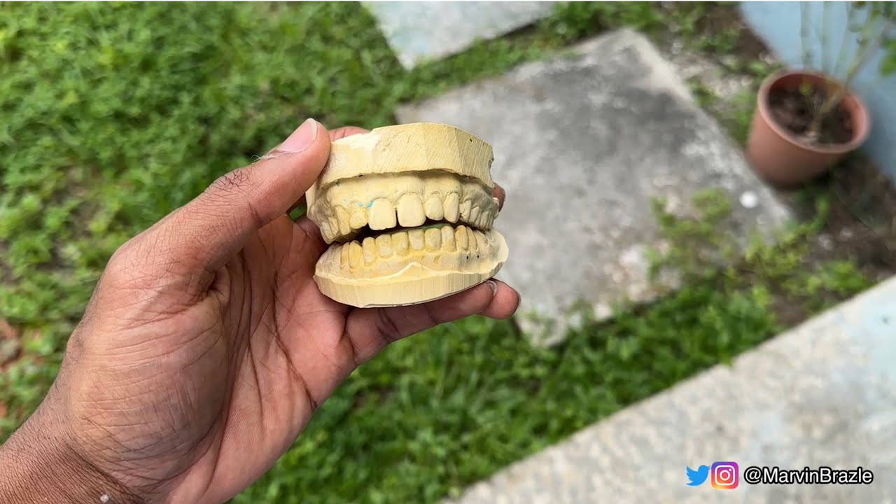 How to make a mold of your teeth (grillz dental impression) YouTube
