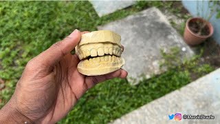 How to make a mold of your teeth (grillz dental impression)