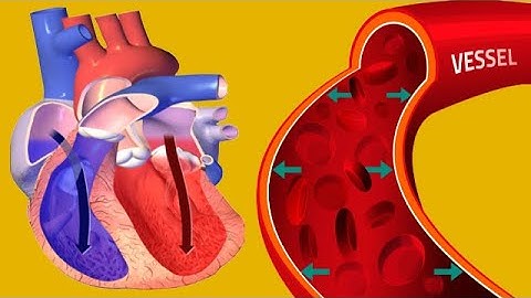 What can cause the diastolic blood pressure to be high