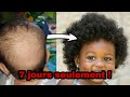 7 JOURS SEULEMENT POUR FAIRE POUSSER LES CHEVEUX DE BÉBÉ, BIEN TOUFFUS !!!