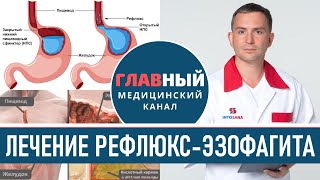 Лечение Рефлюкс-Эзофагита. Гастроэзофагеальная рефлюксная болезнь. Гастроэзофагеальный рефлюкс