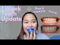 7 DAYS using Teeth Whitening Kit (ibcccndc) | Anadel Rae