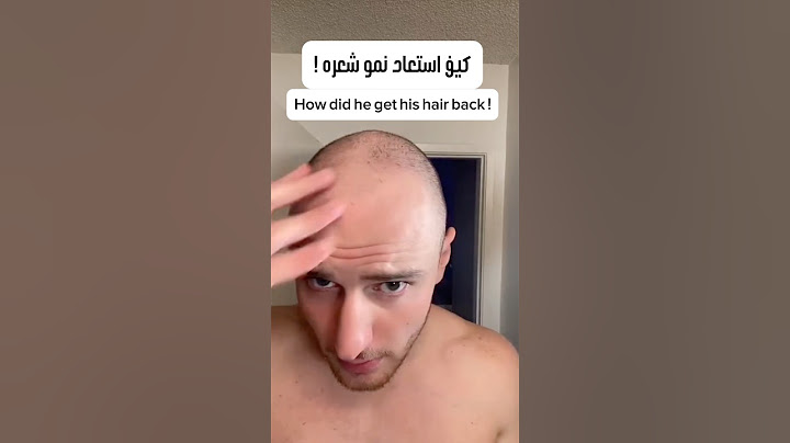 علاج التساقط واستعادة نمو الشعر