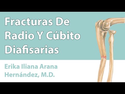 Vídeo: Cúbito: Estructura, Fractura, Después De Fractura