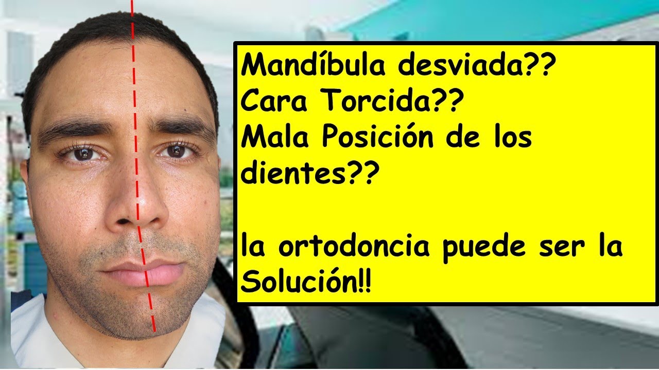 Tienes la cara desviada?La mandíbula hacia un lado??..Puede ser la mala posición de tus Tienes la cara desviada?La mandíbula hacia un lado??..Puede ser la mala posición de tus
