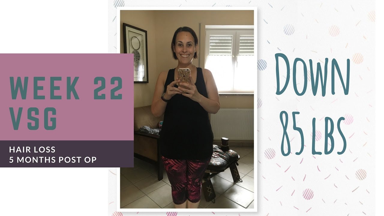 VSG Week 22/Hair Loss (5 Months Post Op) YouTube