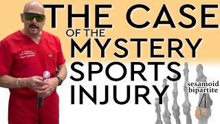 The Case of the Mystery Sports Injury