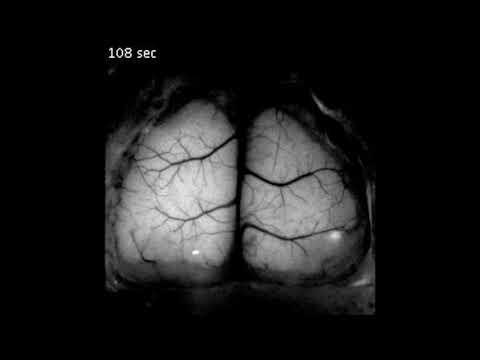 Mouse brain scan at 5x speed