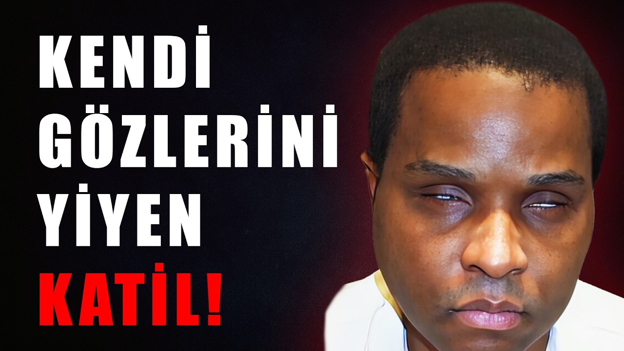 KENDİ GÖZLERİNİ YİYEN KATİL! - ANDRE THOMAS - DEDEKTİF VAKALARI