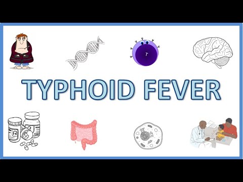  Typhoid Fever - Causes, Pathogenesis, Signs and Symptoms, Diagnosis, Treatment and Prevention