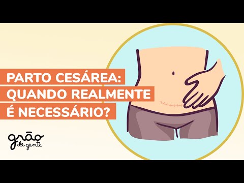 PARTO CESÁREA: CONHEÇA 8 INDICAÇÕES MÉDICAS