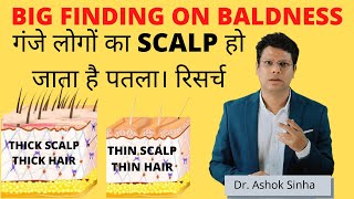 SCALP  पतला होने से होता है , HAIR THINNING और गंजापन। रिसर्च | Dr. Ashok Sinha