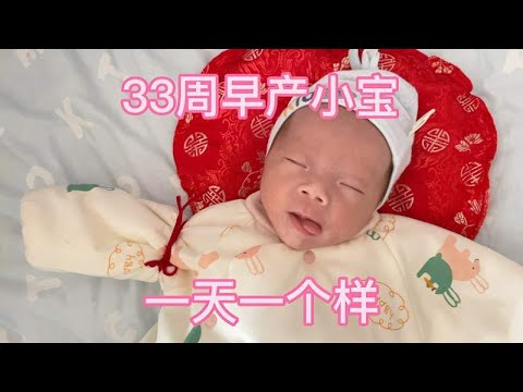 33周早产小宝出生3斤4两，马上就要满月了，一天一个样，变化真大