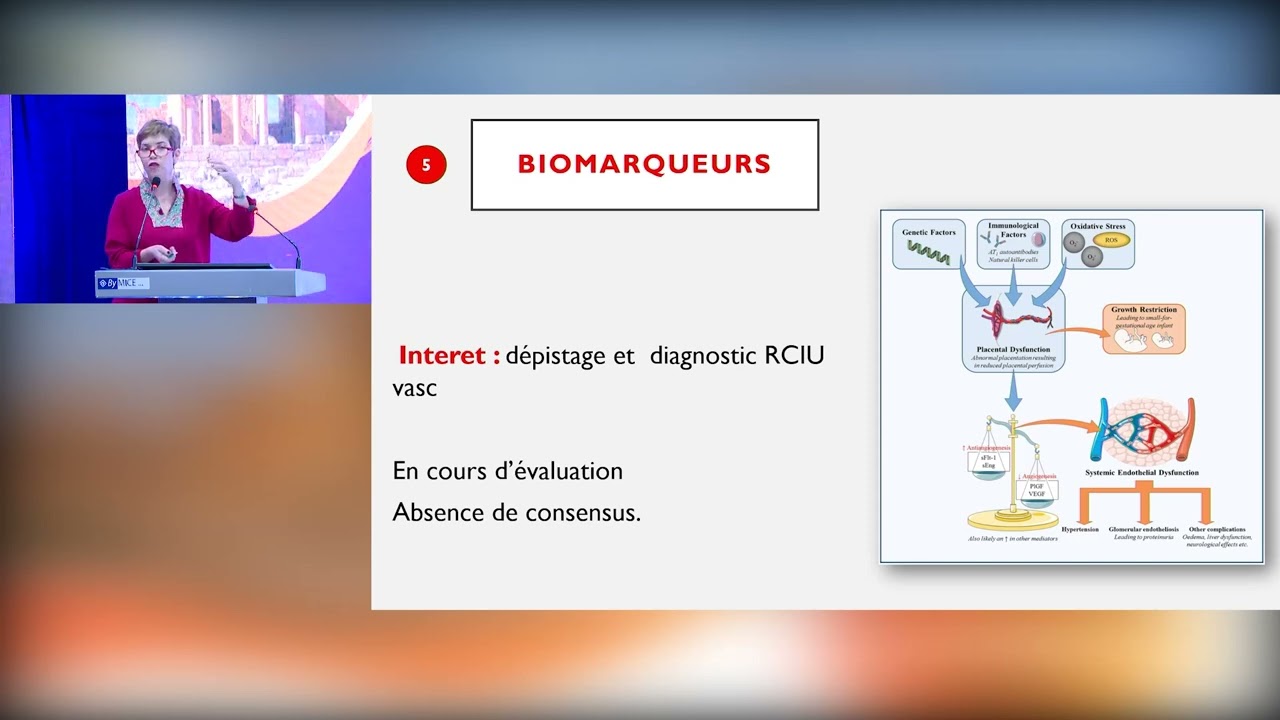 Congrès national STGO 2024 - RCIU vasculaire - DALENDA CHELLI