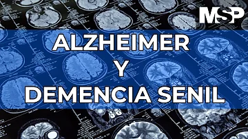 ¿Qué es peor el Alzheimer o la demencia?