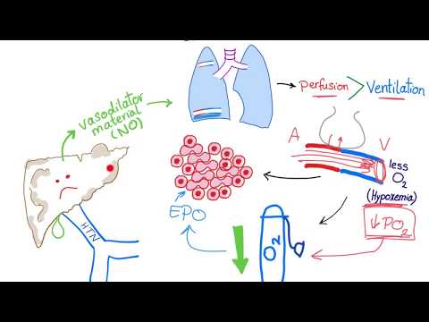 Video: Was ist hepatopulmonaler Shunt?