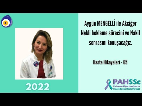 Hasta Hikayeleri - Aygün MENGELLİ ile Akciğer Nakli Bekleme Süreci ve Nakli Sonrası - 65