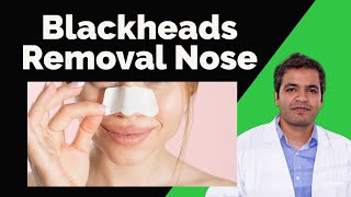 BLACKHEAD Removal Nose: Blackheads Extraction | Blackheads Removal Cream