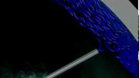 Dispersive Viscoelastic for Phaco and  I A