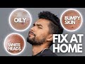 6 Skin Problems You Can Fix At Home FAST!