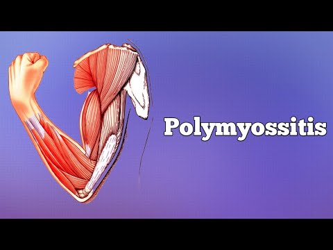 Videó: Oszsifizáló Myositis - Okai, Tünetei és Kezelése