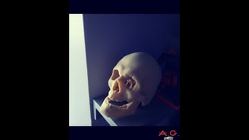 Halloween Skull Earphones/ Earpods Holder Storage- 3D printable from CT Scan.