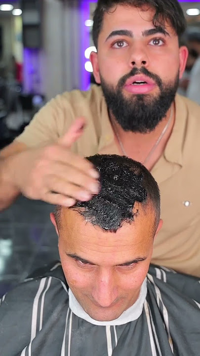 اخفاء الصلع