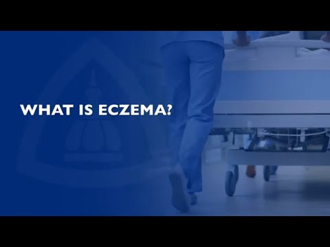 What You Need to Know about Eczema | FAQ