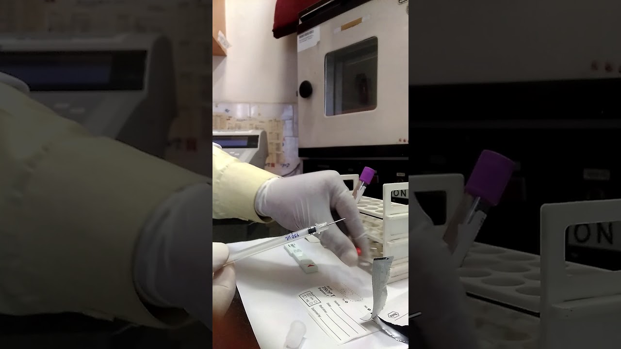 TROP T test processing in LIVE । TROP T positive result। Cobas । Roche। Qualitative immunological ।