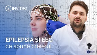 Epilepsia și EEG | Ce spune creierul