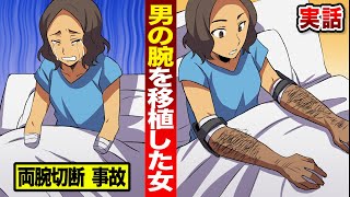 【実話】両腕がチン切れた女。男の腕を移植したら...全く体に合わない。