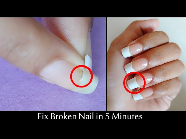 Part 1 I'm not ready to let this nail go so I am fixing it with super... |  TikTok