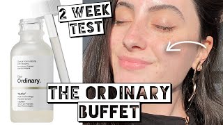 TESTING THE ORDINARY BUFFET ON ACNE SCARRING & DRY SENSITIVE SKIN FOR 2 WEEKS screenshot 4